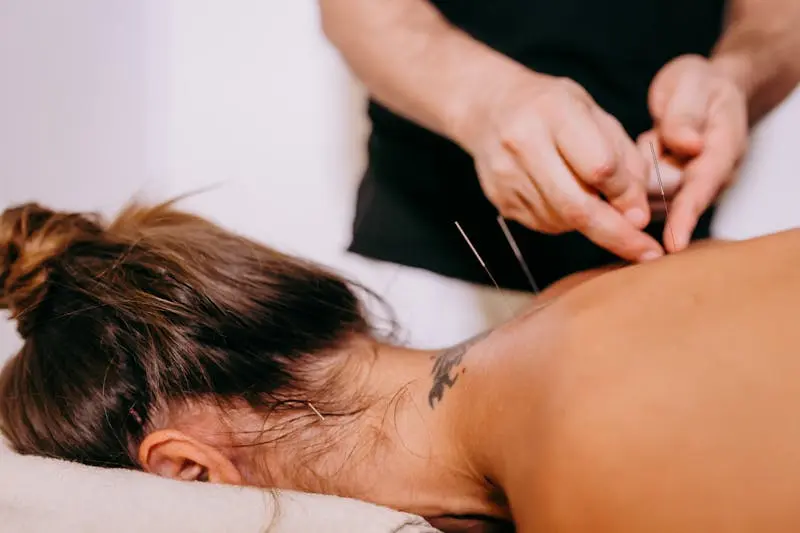 Practitioner inserting thin dry needling needles into a patient upper back and neck area